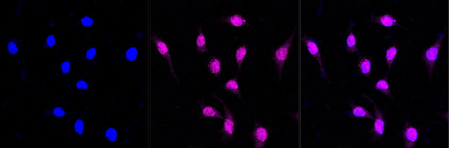 MTH1 Antibody in Immunocytochemistry (ICC/IF)