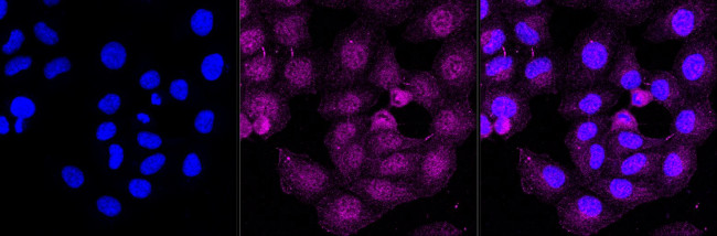 ORP1 Antibody in Immunocytochemistry (ICC/IF)