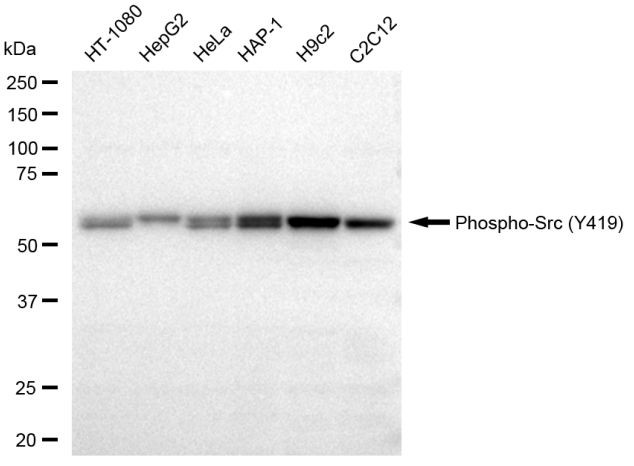 Phospho-SRC (Tyr419) Antibody in Western Blot (WB)