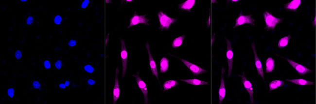 Phospho-PKC alpha (Thr638) Antibody in Immunocytochemistry (ICC/IF)