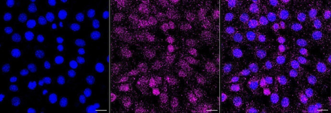 RASA1 Antibody in Immunocytochemistry (ICC/IF)