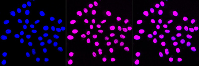 SMARCC1 Antibody in Immunocytochemistry (ICC/IF)