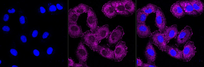 SPINK5 Antibody in Immunocytochemistry (ICC/IF)
