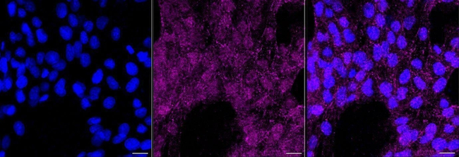Phospho-STAT3 (Tyr705) Antibody in Immunocytochemistry (ICC/IF)