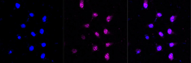 UFC1 Antibody in Immunocytochemistry (ICC/IF)