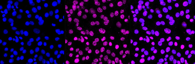 ZHX2 Antibody in Immunocytochemistry (ICC/IF)