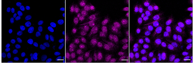 Cullin 4A Antibody in Immunocytochemistry (ICC/IF)