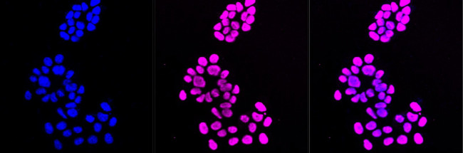H3K56ac Antibody in Immunocytochemistry (ICC/IF)