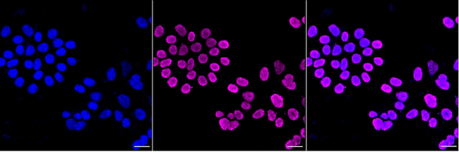 H3K18ac Antibody in Immunocytochemistry (ICC/IF)