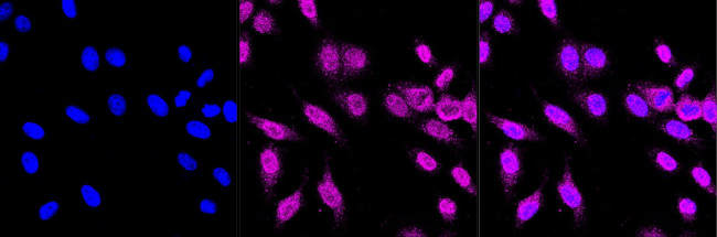 MUT Antibody in Immunocytochemistry (ICC/IF)
