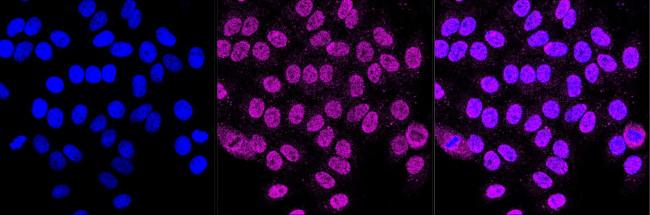 MUT Antibody in Immunocytochemistry (ICC/IF)