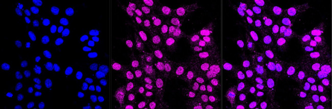 SYNE3 Antibody in Immunocytochemistry (ICC/IF)
