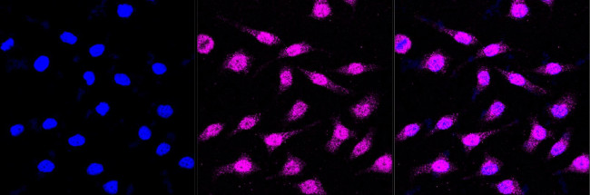 SYPL1 Antibody in Immunocytochemistry (ICC/IF)