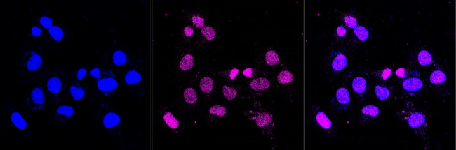 TRIB3 Antibody in Immunocytochemistry (ICC/IF)
