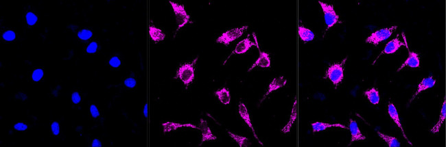 TSFM Antibody in Immunocytochemistry (ICC/IF)