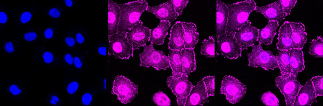 VASP Antibody in Immunocytochemistry (ICC/IF)