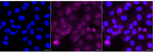 CrkL Antibody in Immunocytochemistry (ICC/IF)