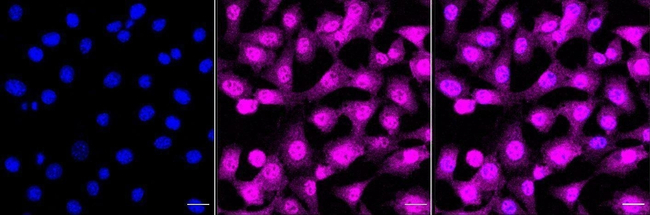 ACAT2 Antibody in Immunocytochemistry (ICC/IF)