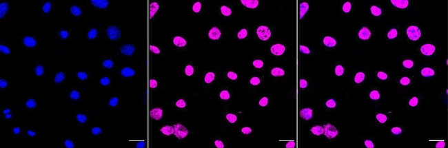 HDAC1 Antibody in Immunocytochemistry (ICC/IF)
