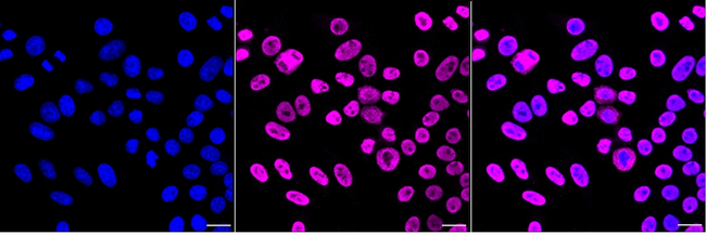 hnRNP K Antibody in Immunocytochemistry (ICC/IF)