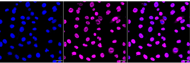 hnRNP M Antibody in Immunocytochemistry (ICC/IF)