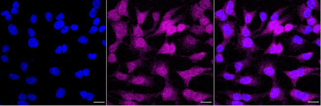 KATNA1 Antibody in Immunocytochemistry (ICC/IF)