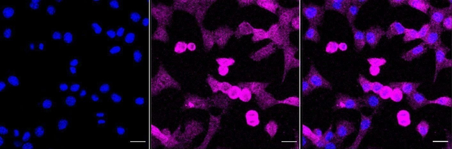 Galectin 3 Antibody in Immunocytochemistry (ICC/IF)