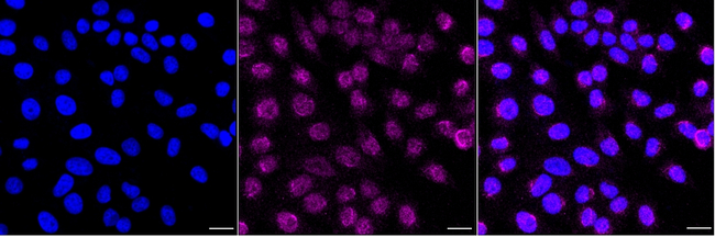 LMAN1 Antibody in Immunocytochemistry (ICC/IF)