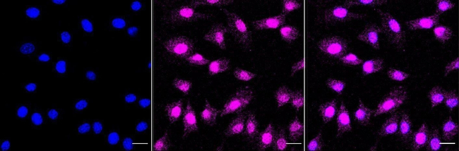 Phospho-p38 MAPK (Thr180) Antibody in Immunocytochemistry (ICC/IF)