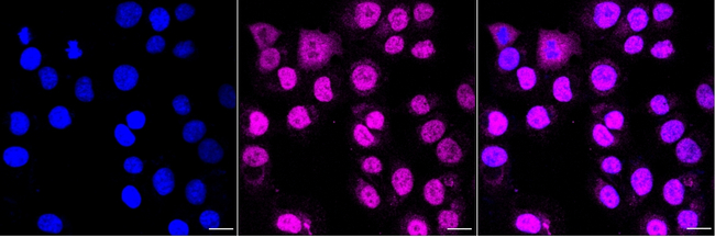 PFKFB3 Antibody in Immunocytochemistry (ICC/IF)