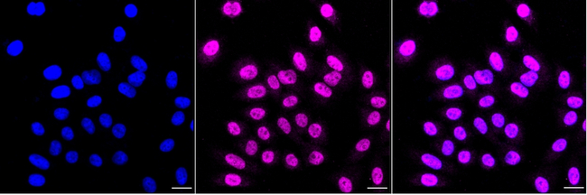 RPA70 Antibody in Immunocytochemistry (ICC/IF)