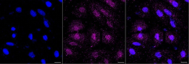 TGF beta-1 Antibody in Immunocytochemistry (ICC/IF)