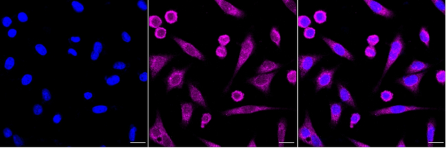 gamma Tubulin Antibody in Immunocytochemistry (ICC/IF)