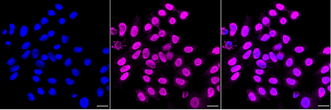 Ku70 Antibody in Immunocytochemistry (ICC/IF)