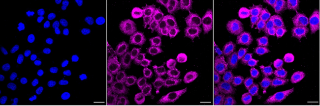 YES1 Antibody in Immunocytochemistry (ICC/IF)