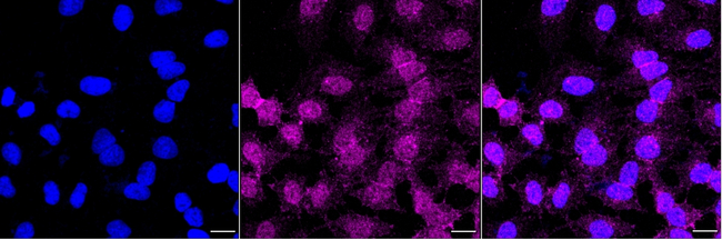 B7-H3 Antibody in Immunocytochemistry (ICC/IF)