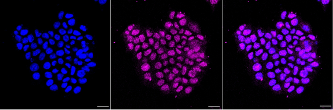 M-CSF Antibody in Immunocytochemistry (ICC/IF)