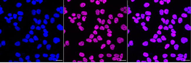 CtBP2 Antibody in Immunocytochemistry (ICC/IF)