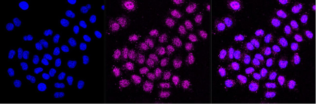 CYFIP1 Antibody in Immunocytochemistry (ICC/IF)