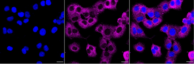DCP1A Antibody in Immunocytochemistry (ICC/IF)