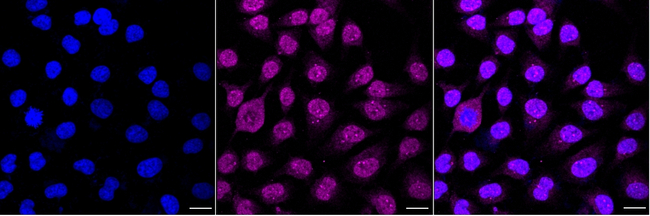 DGAT1 Antibody in Immunocytochemistry (ICC/IF)