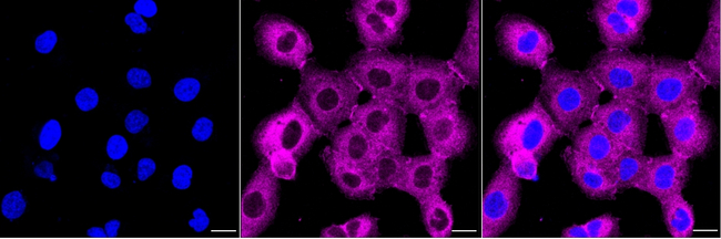 Dynamin 2 Antibody in Immunocytochemistry (ICC/IF)