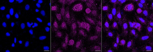 DSC1 Antibody in Immunocytochemistry (ICC/IF)