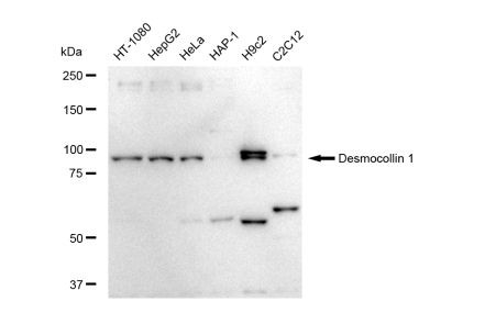 DSC1 Antibody in Western Blot (WB)