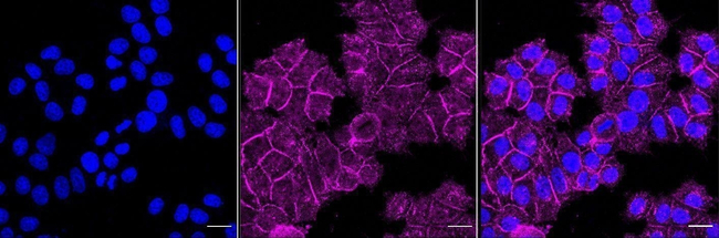Desmoglein 2 Antibody in Immunocytochemistry (ICC/IF)
