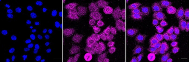 Desmoplakin Antibody in Immunocytochemistry (ICC/IF)