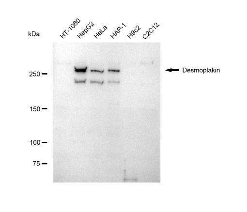 Desmoplakin Antibody in Western Blot (WB)
