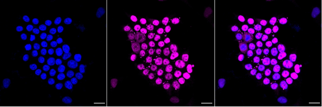 DUT Antibody in Immunocytochemistry (ICC/IF)