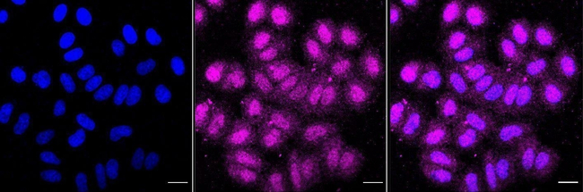 DYNLL1 Antibody in Immunocytochemistry (ICC/IF)