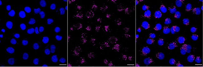 EEA1 Antibody in Immunocytochemistry (ICC/IF)